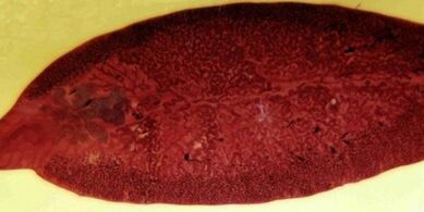 parasito trematodo como eliminar do corpo
