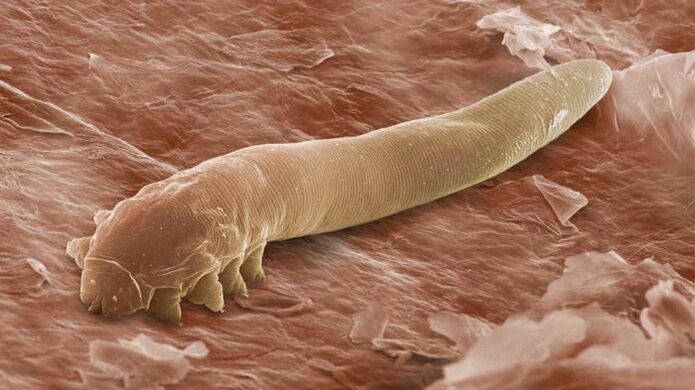 Parasito subcutáneo ao microscopio